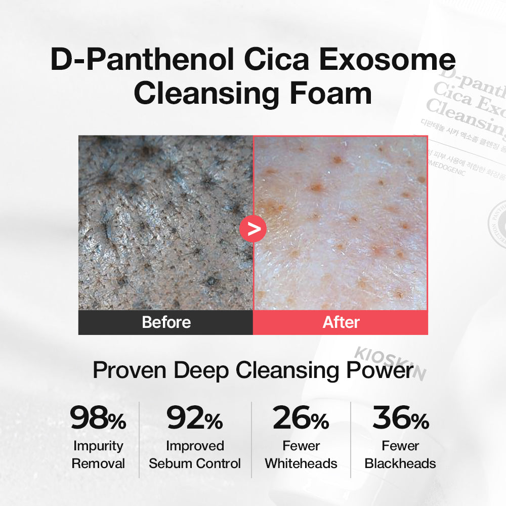 D-Panthenol Cica Exosome Cleansing Foam