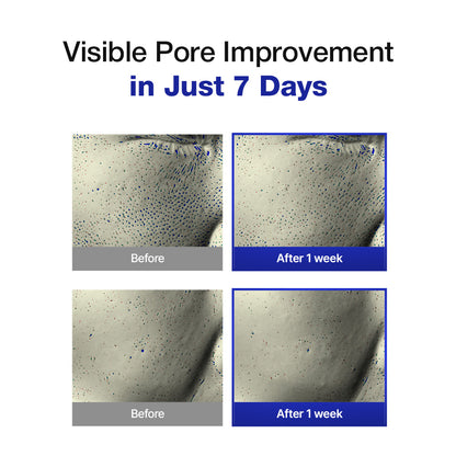 Exosome Skin Balancing Pad