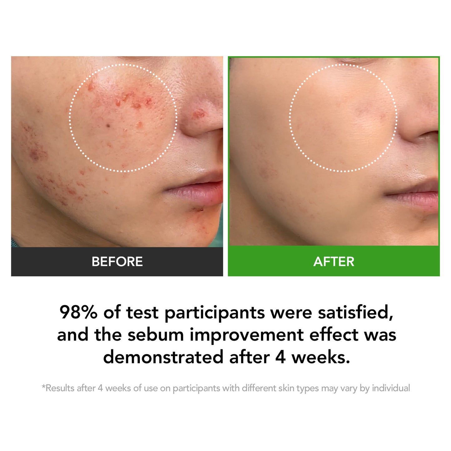 D-Panthenol 15.5 Barrier Repair Cream